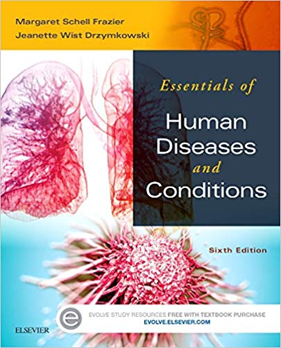 Test Bank for Essentials of Human Diseases and Conditions 6th Edition by Margaret Schell Frazier